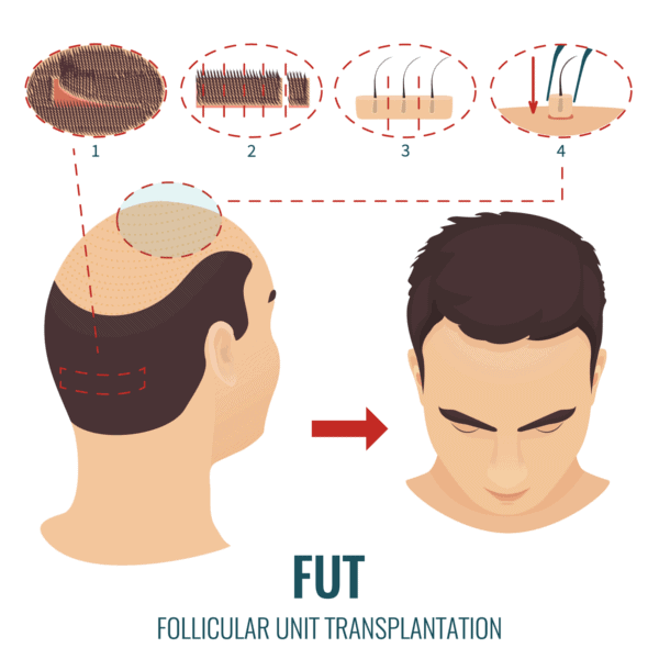 These images show scalps after hair transplant surgery  not what happens  when you share a wig with a friend  Fact Check