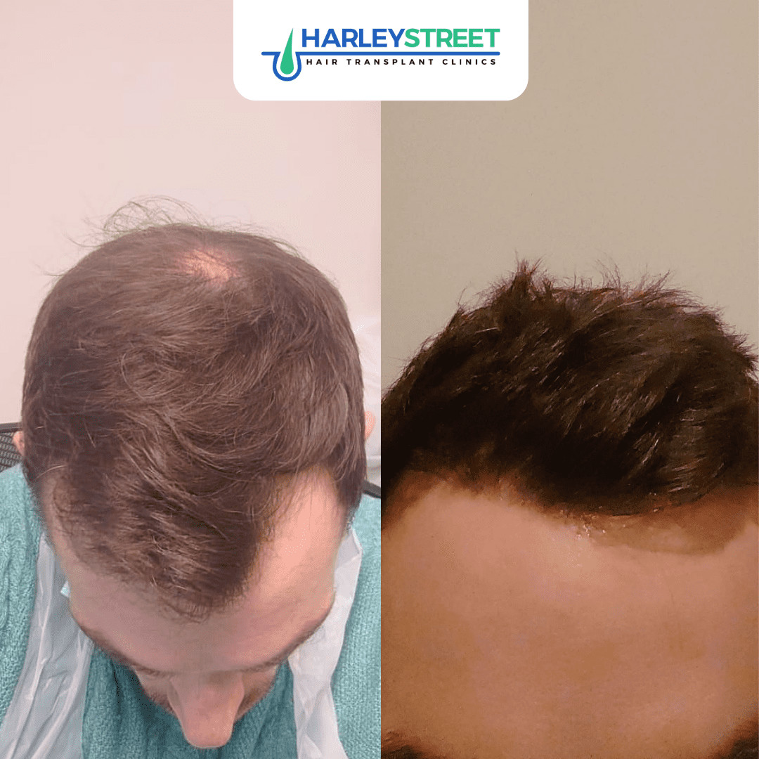 Free Consultation - Harley Street HTC Free Consultation - Harley Street HTC