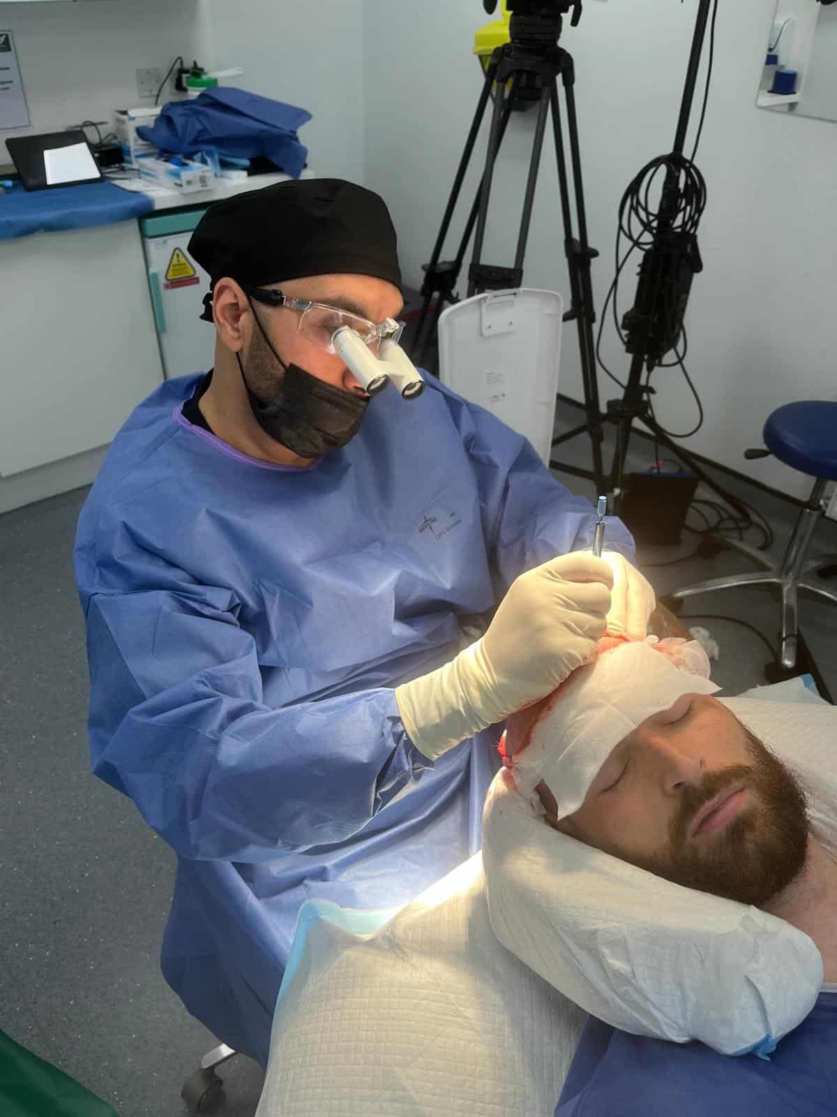 Surgeon Performed vs Technician Led FUE Dr Elgindi performing Ronnie Vint's hair transplant