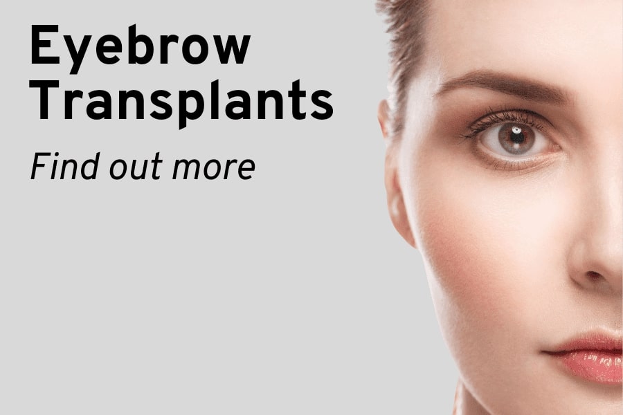 Eyebrow transplantation image