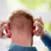 Hair transplant itching