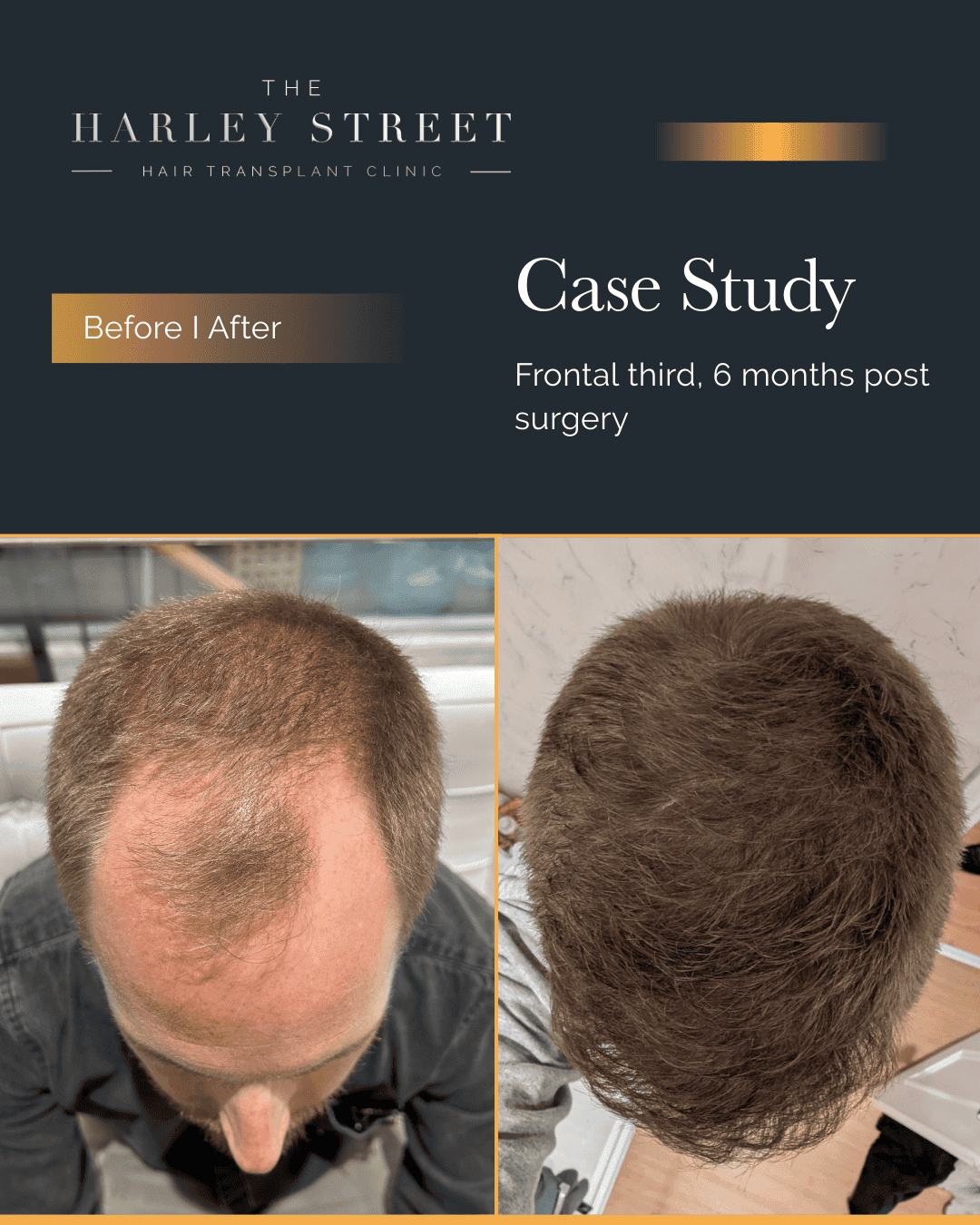 Harley Street HT pt Hughes, hairline aerial view