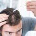 Man applying topical finasteride and minoxidil combo