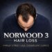 Norwood 3 scale hair loss