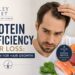 Protein Deficiency Hair Loss
