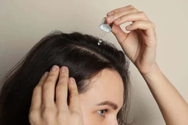azelaic acid for hair loss and growth