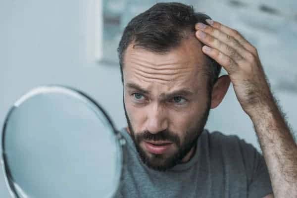 does creatine cause hair loss