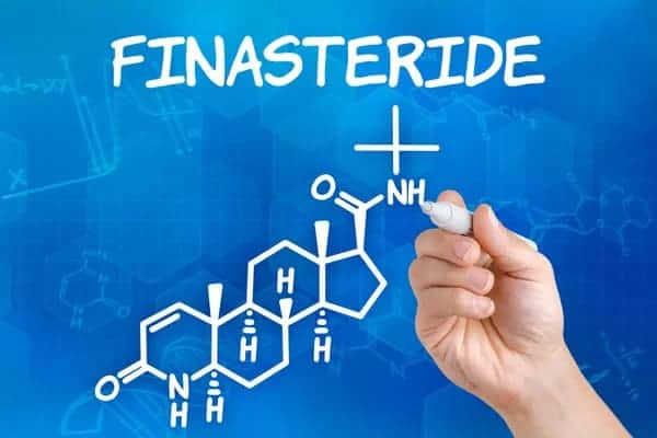 finasteride for hair loss