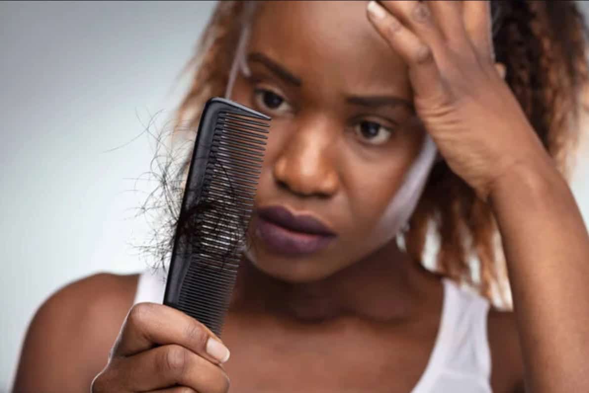 hair loss in black women