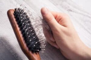 hair transplant shedding hair on comb