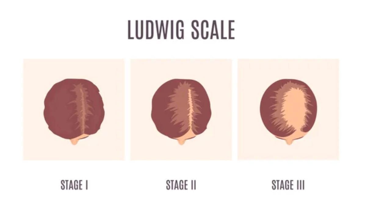 ludwig scale 1 2 3