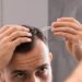 man applying topical finasteride to scalp