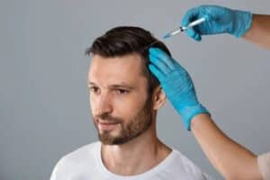 man doing prp on head for hair loss