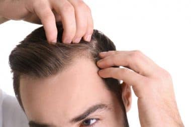 man with widow's peak hairline