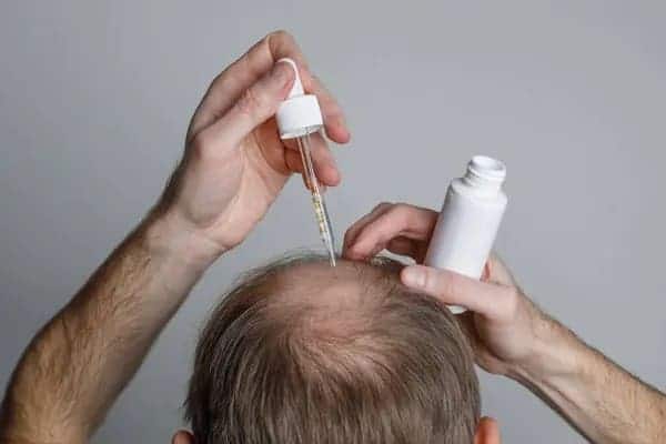 stemoxydine for hair loss