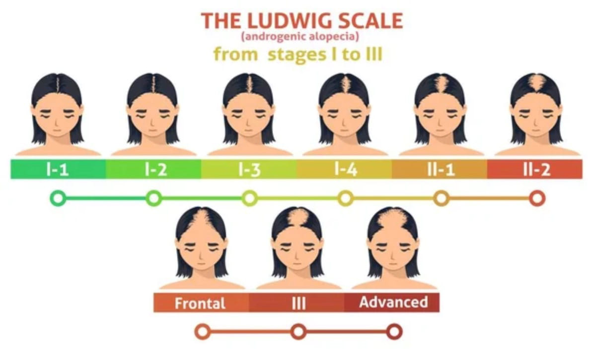 the ludwig scale stages