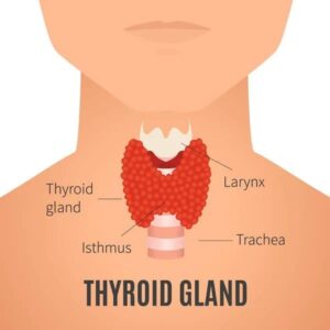 thyroid condition