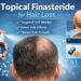 topical finasteride side effects